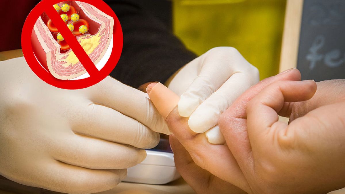 Nowe normy poziomu cholesterolu i trójglicerydów. Sprawdź co oznaczają wyniki lipidogramu