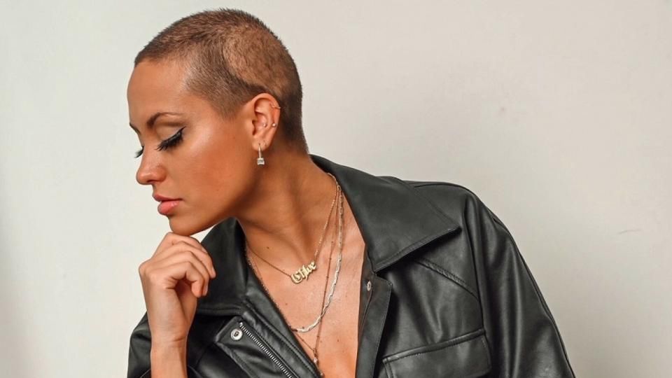 Chloe Thomas ogoliła głowę, by zwiększać świadomość na temat łysienia plackowatego