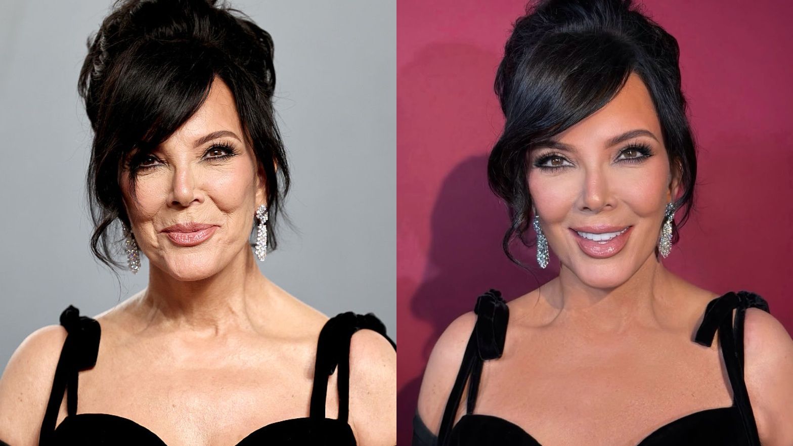 Kris Jenner przed i po retuszu
