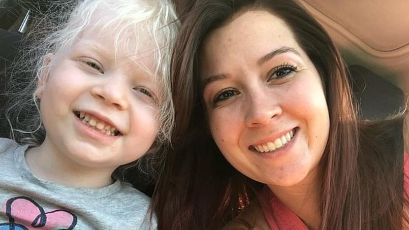 Zerina cierpi na zespół Hermanskiego-Pudlaka