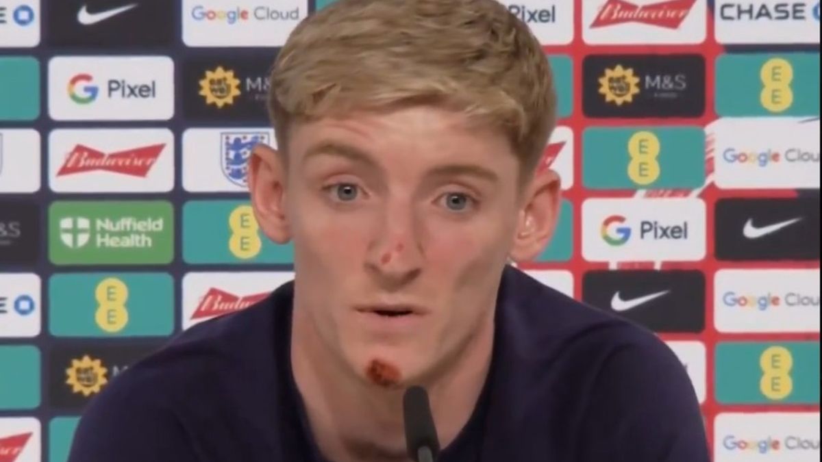 Anthony Gordon na konferencji prasowej po wypadku