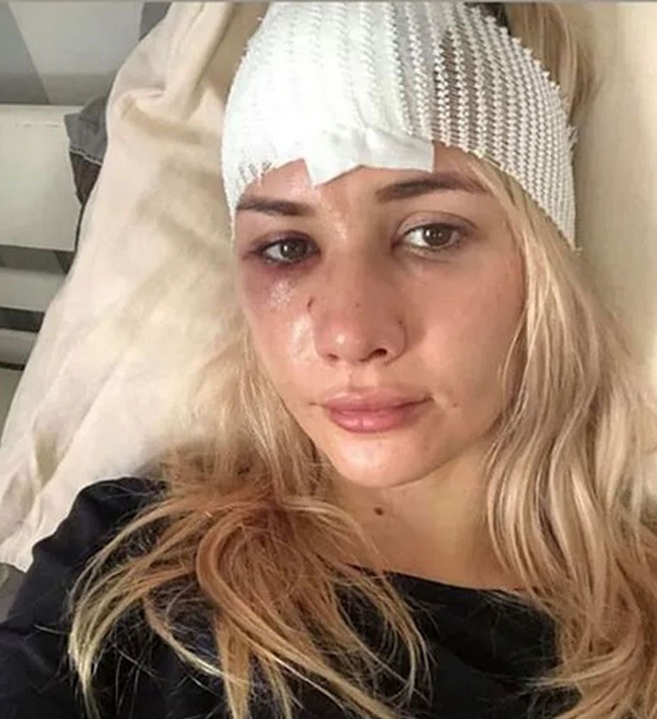 Beata Grucela z "Love Island" miała wypadek samochodowy