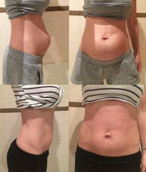 Odpowiednie ćwiczenia mogą poprawić stan brzucha po ciąży