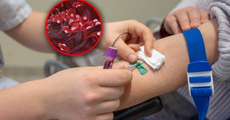 Niższa hemoglobina może sprzyjać zdrowiu. Naukowcy odkryli zaskakujące korzyści