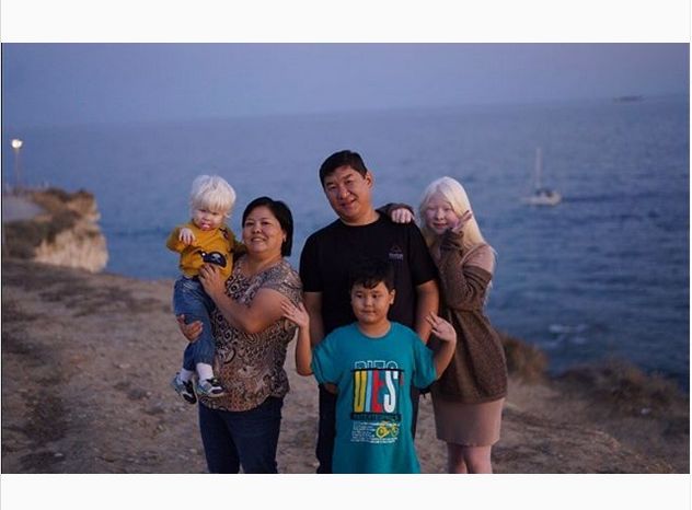 W rodzinie zdarzały się wcześniej przypadki albinizmu (instagram)