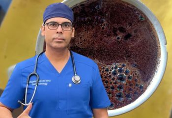 Gastroenterolog przejrzał 10 tys. skanów. Mówi wprost o piciu kawy