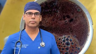 Gastroenterolog przejrzał 10 tys. skanów wątroby. Mówi o piciu kawy