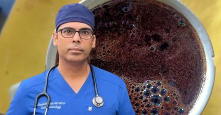 Gastroenterolog przejrzał 10 tys. skanów wątroby. Mówi o piciu kawy