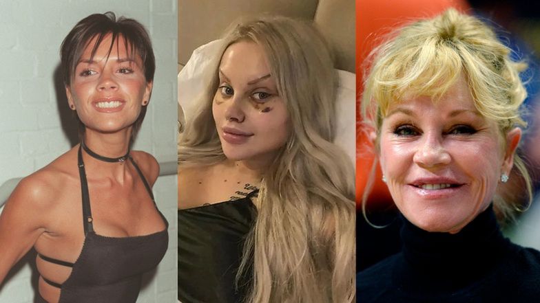 Te gwiazdy pożałowały operacji plastycznych