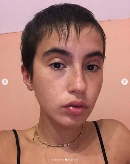 Ola Kowalska pokazuje efekty choroby
