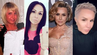 Tak zmieniała się Blanka Lipińska. Metamorfozy zawdzięcza fryzjerom i lekarzom medycyny estetycznej (ZDJĘCIA)