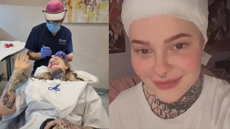 Monika Miller opowiedziała o przeszczepie włosów: "Słyszałam, jak wycinają mi skórę"