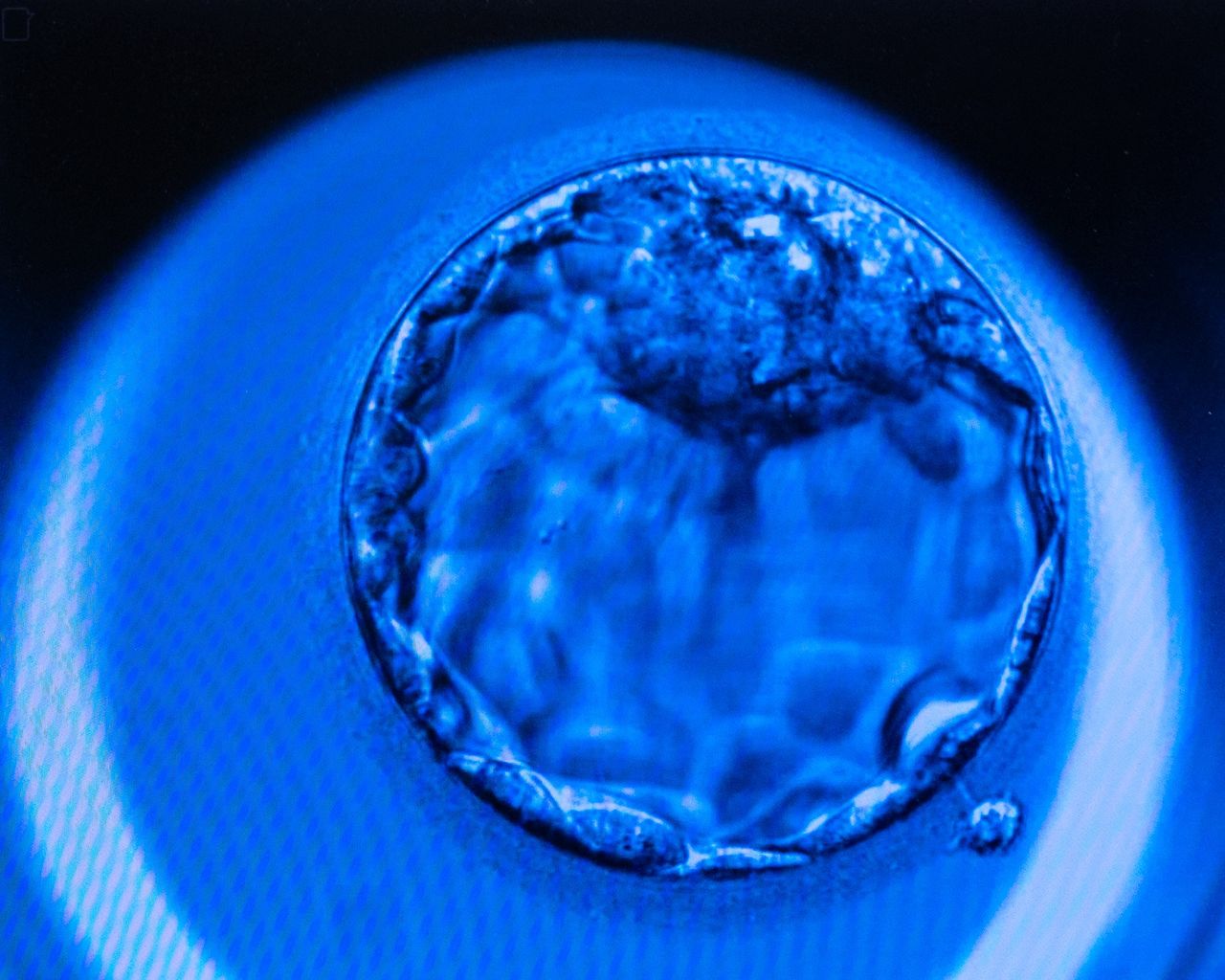 OMAHA, NE - May 10: On a computer screen, lab technicians view a 5-day-old embryo at the blastocyst stage of development at the Heartland Fertility in Omaha, Nebraska on May 10, 2022. The governance of embryos may be caught up in the trigger laws enacted after Roe v. Wade is potentially overturned by the Supreme Court. (Misty Prochaska For The Washington Post via Getty Images)