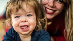 Zespół Huntera - objawy, rozpoznanie, leczenie, rokowania