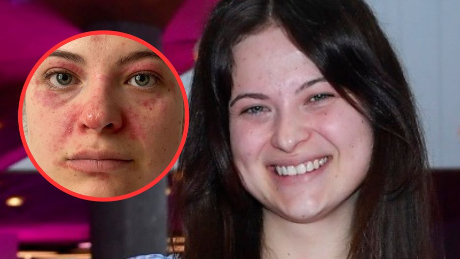Martyna Kaczmarek ostrzega przed popularnym trendem, fot. Instagram.com/martynakaczmarek