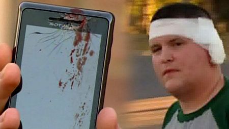 Co może zrobić z uchem eksplodujący telefon komórkowy? 1