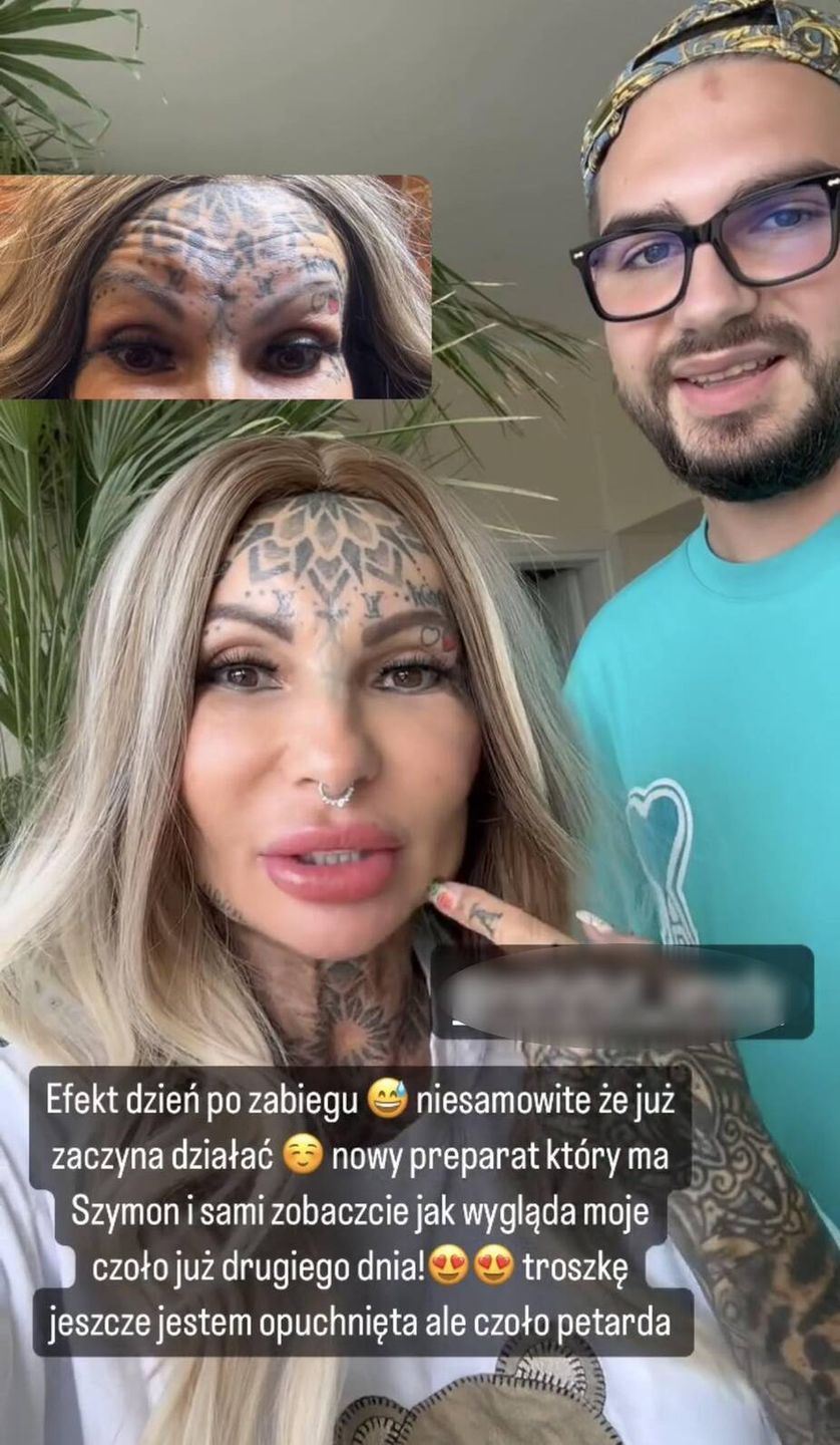 Adrianna Eisenbach chwali się kolejnym zabiegiem upiększającym