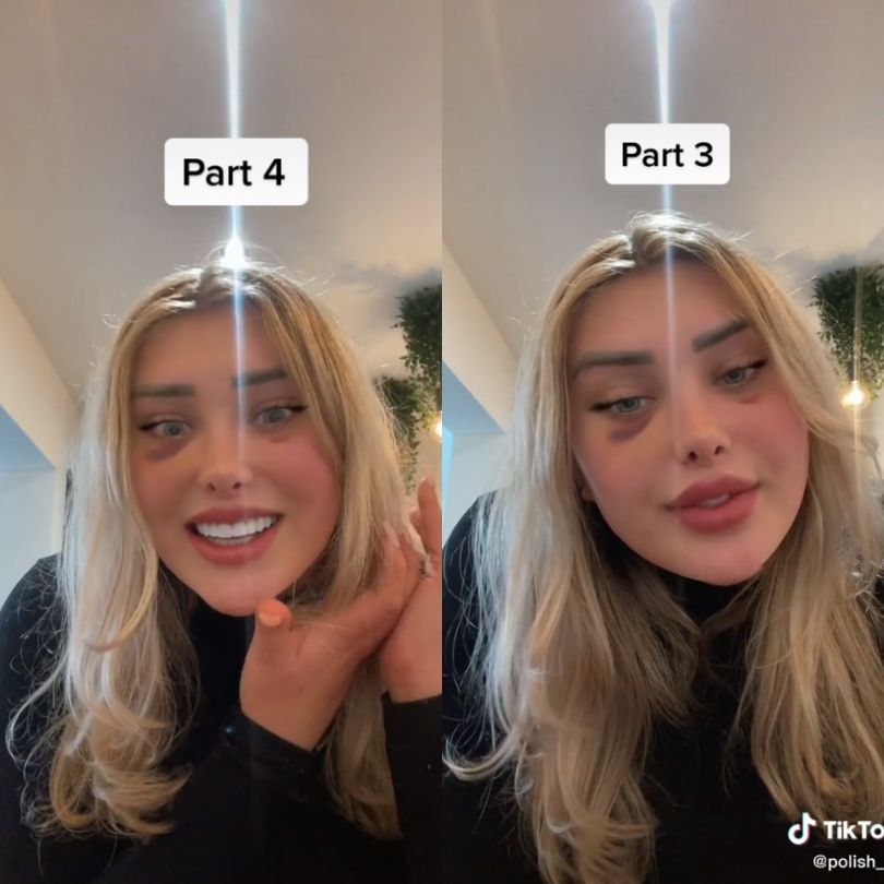 Tiktokerka wspomina dramat podczas lotu samolotem po zabiegach