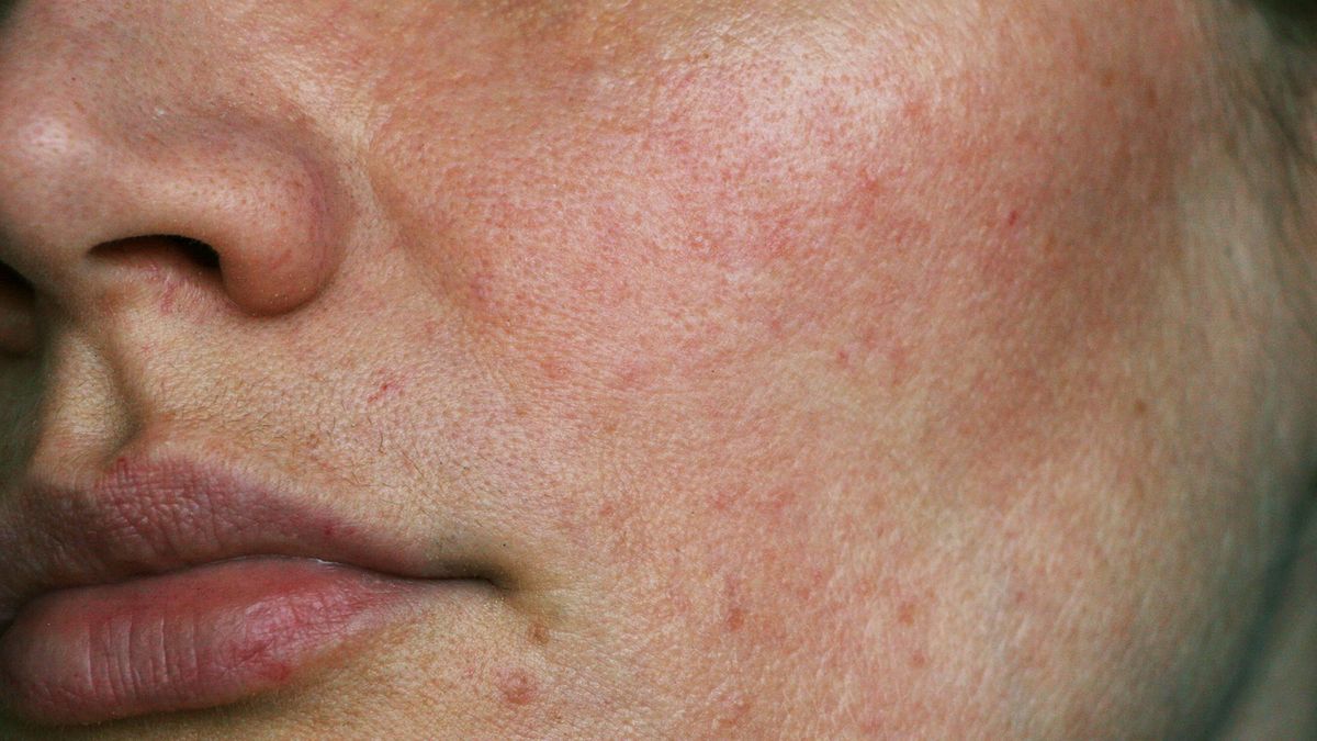 Nadużywanie leków może uszkodzić wątrobę