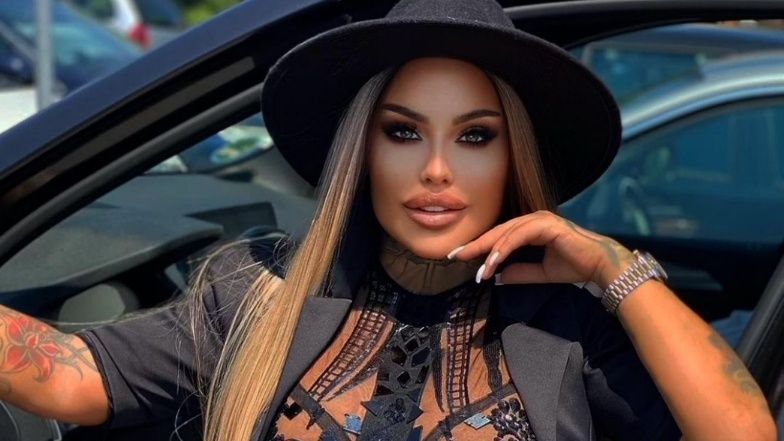 Laluna chwali się swoim nowym uzębieniem