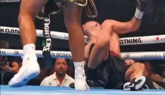 Oto skutki strasznego nokautu