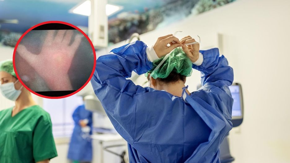 Podczas fetoskopii jedno z dzieci pomachało do kamery