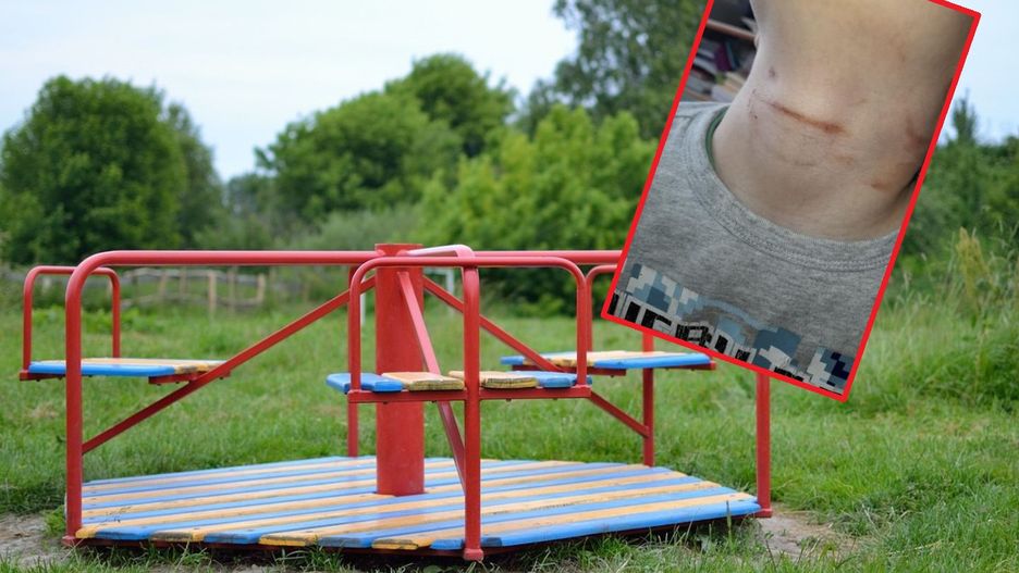 Nauczycielka zgłosiła, że dzieci są bite. Została zwolniona