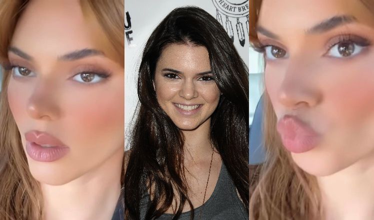 Kendall Jenner prezentuje obfite usta