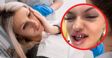 Nabrani na "tureckie zęby". Dentyści patrzą i nie wierzą