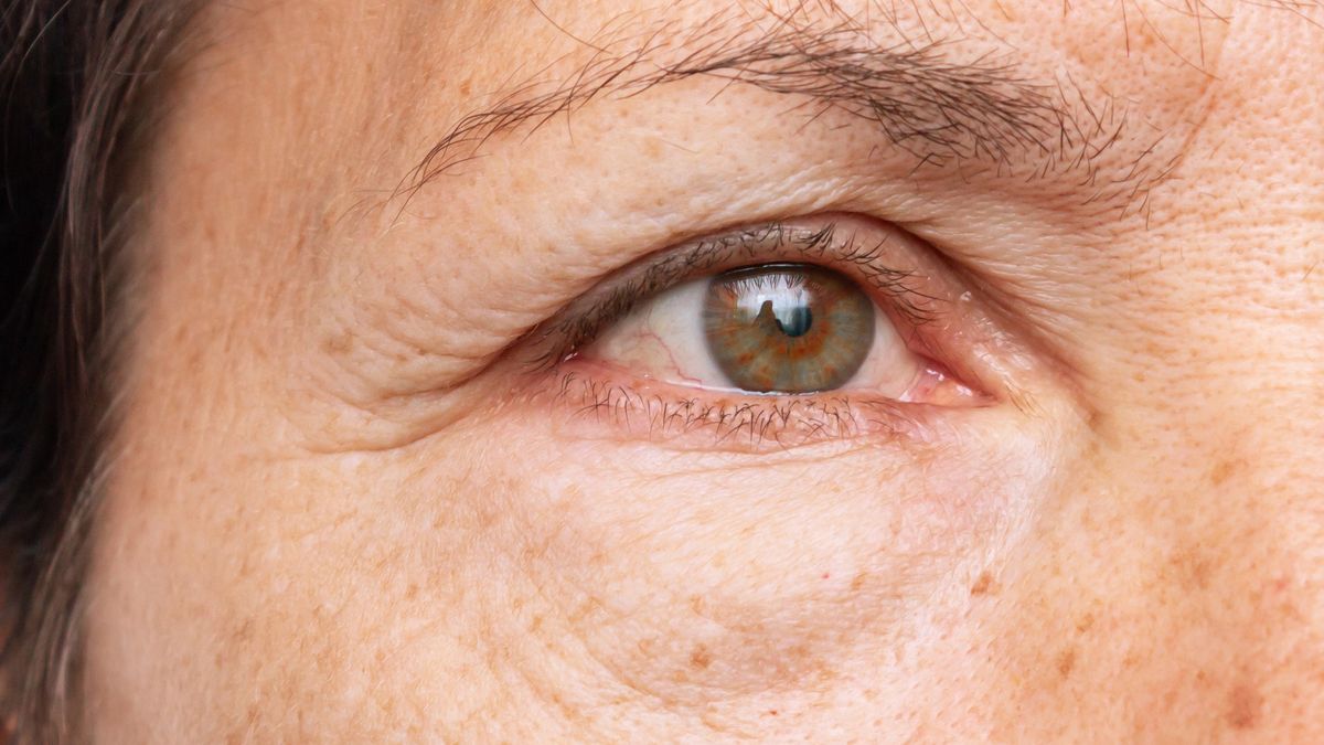 Jak poradzić sobie z opuchlizną twarzy? 