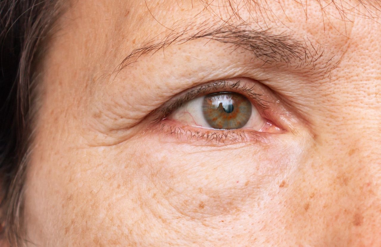 Jak poradzić sobie z opuchlizną twarzy? 