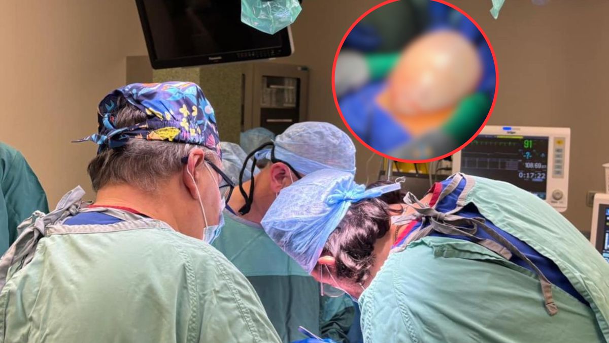 Pacjentka trafiła w ręce lekarzy. Guz miał 8 kg