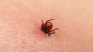 Uważajcie na kleszcze. Statystyki są coraz bardziej niepokojące