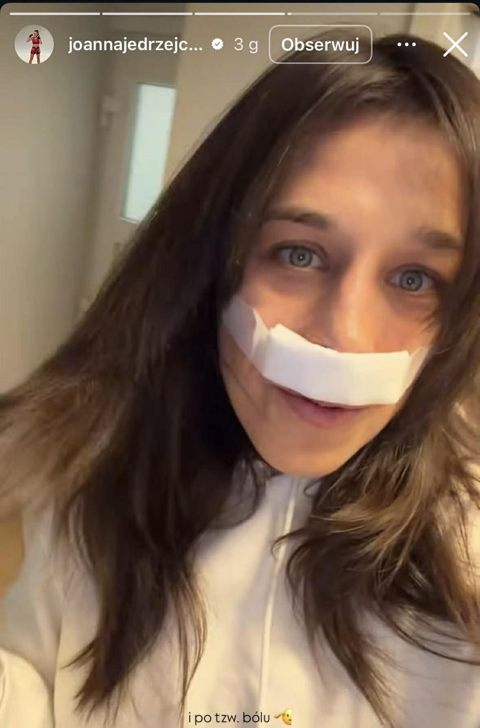 Joanna Jędrzejczyk po operacji nosa