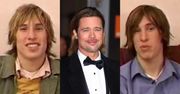 Bliźniacy Schlepp wydali 80 TYSIĘCY ZŁOTYCH, by wyglądać jak Brad Pitt: implanty w policzkach i podbródkach, nowe nosy, uzębienie