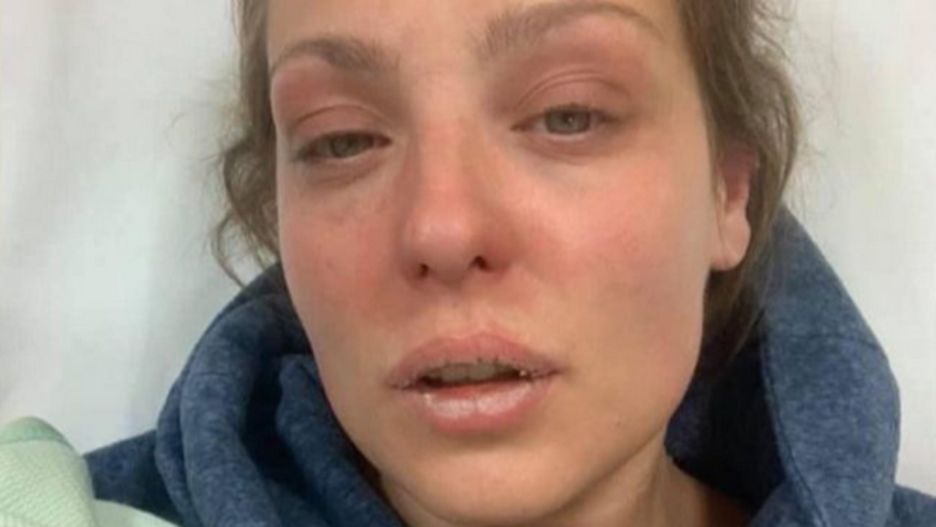 Amy Dowden ma raka piersi