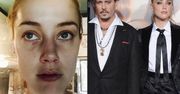Amber Heard przekaże pieniądze od Deppa na walkę z przemocą wobec kobiet!