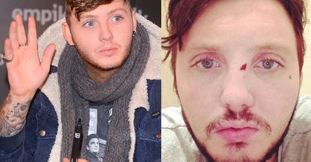 James Arthur POBITY w polskim barze! (FOTO)