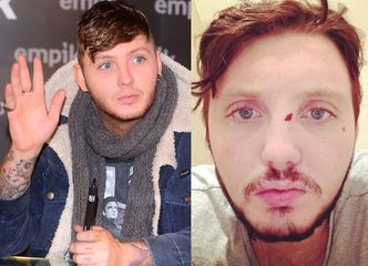 James Arthur POBITY w polskim barze! (FOTO)