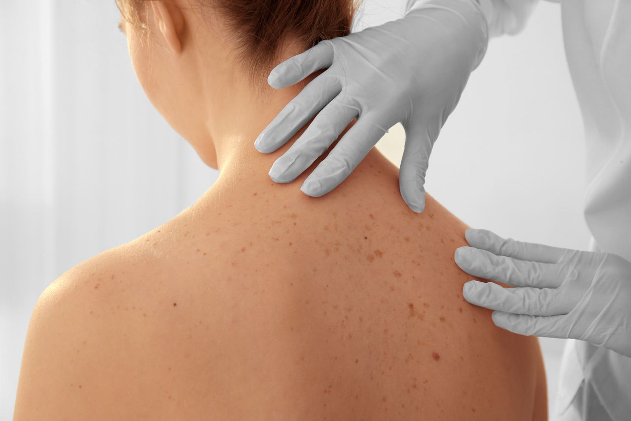 Dermatolog. Tych sygnałów skóry nie bagatelizuj