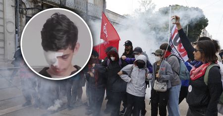 Stracił oko podczas protestów we Francji. Wina policji? Skarga rodziny
