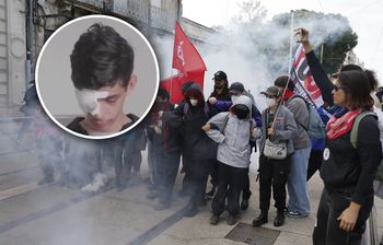 Stracił oko podczas protestów we Francji. Wina policji? Skarga rodziny
