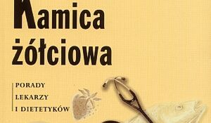 Kamica żółciowa