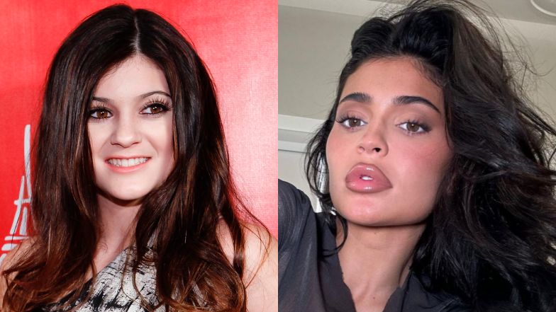 Tak zmieniła się Kylie Jenner