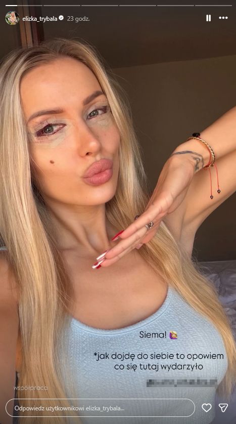 Eliza Trybała zafundowała sobie plastykę powiek