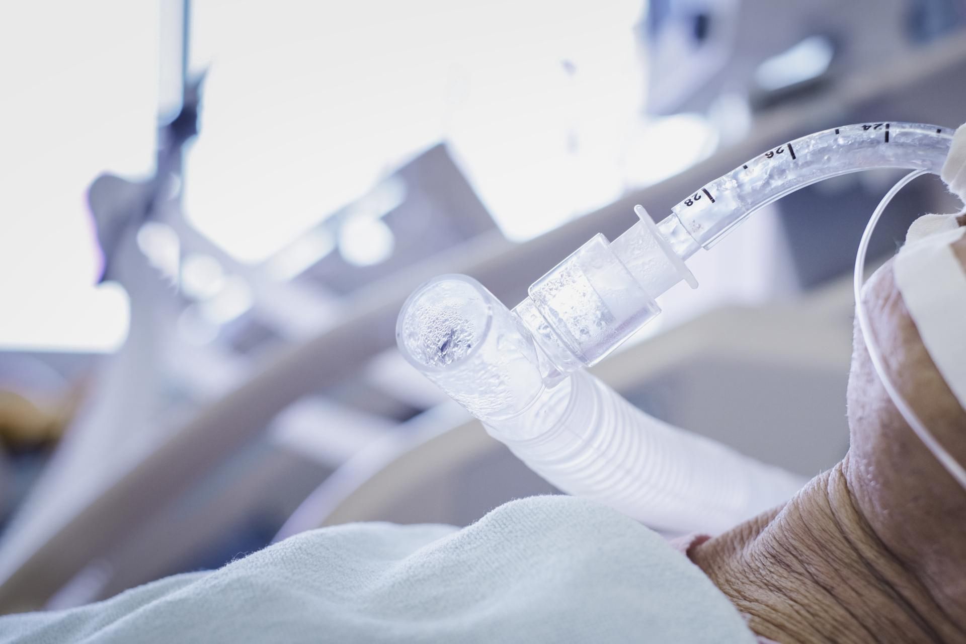 Co trzeci pacjent na oddziale intensywnej terapii ma sepsę