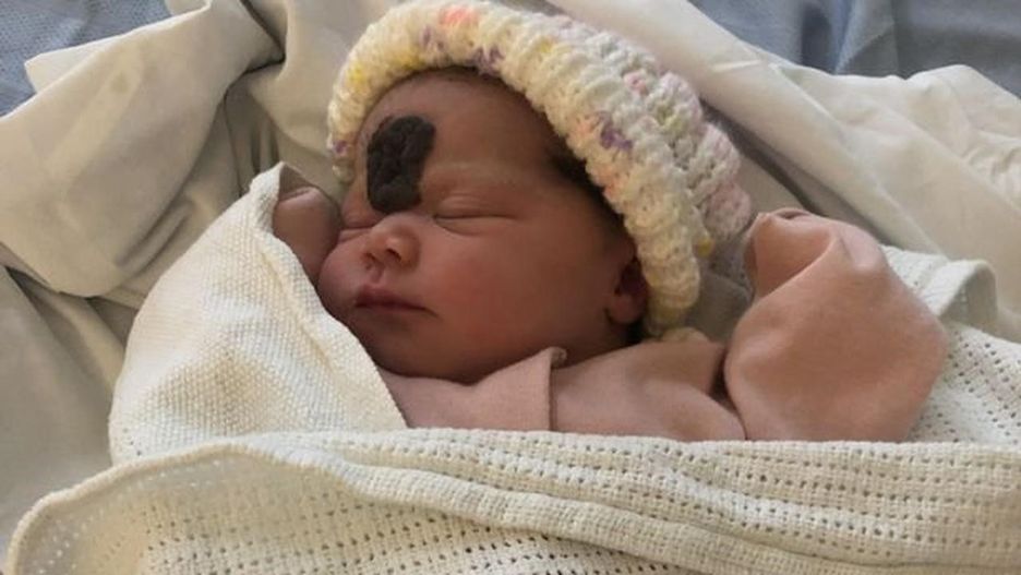 Lekarze nie zgadzali się na operację. Rodzice postanowili dopiąć swego