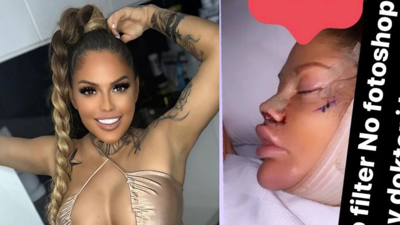 Laluna Unique leci do tureckiej kliniki na kolejną operację