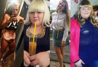Rosjanka schudła 105 KILOGRAMÓW! "Nie miałam kompleksów, ale zaczęłam obawiać się o własne życie" (ZDJĘCIA)