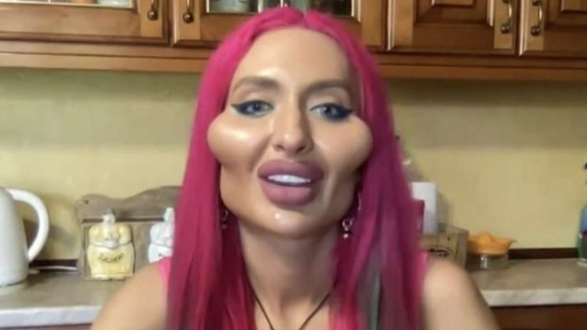 Anastasia Pokreshchuk ma największe policzki na świecie 